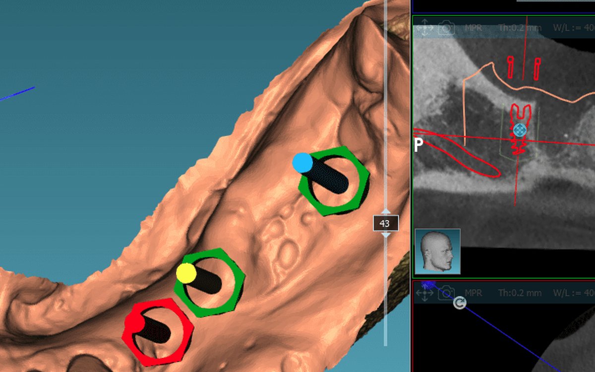 Installation of 3DX-Ray CBCT Viewer — CBCT & DICOM Viewers