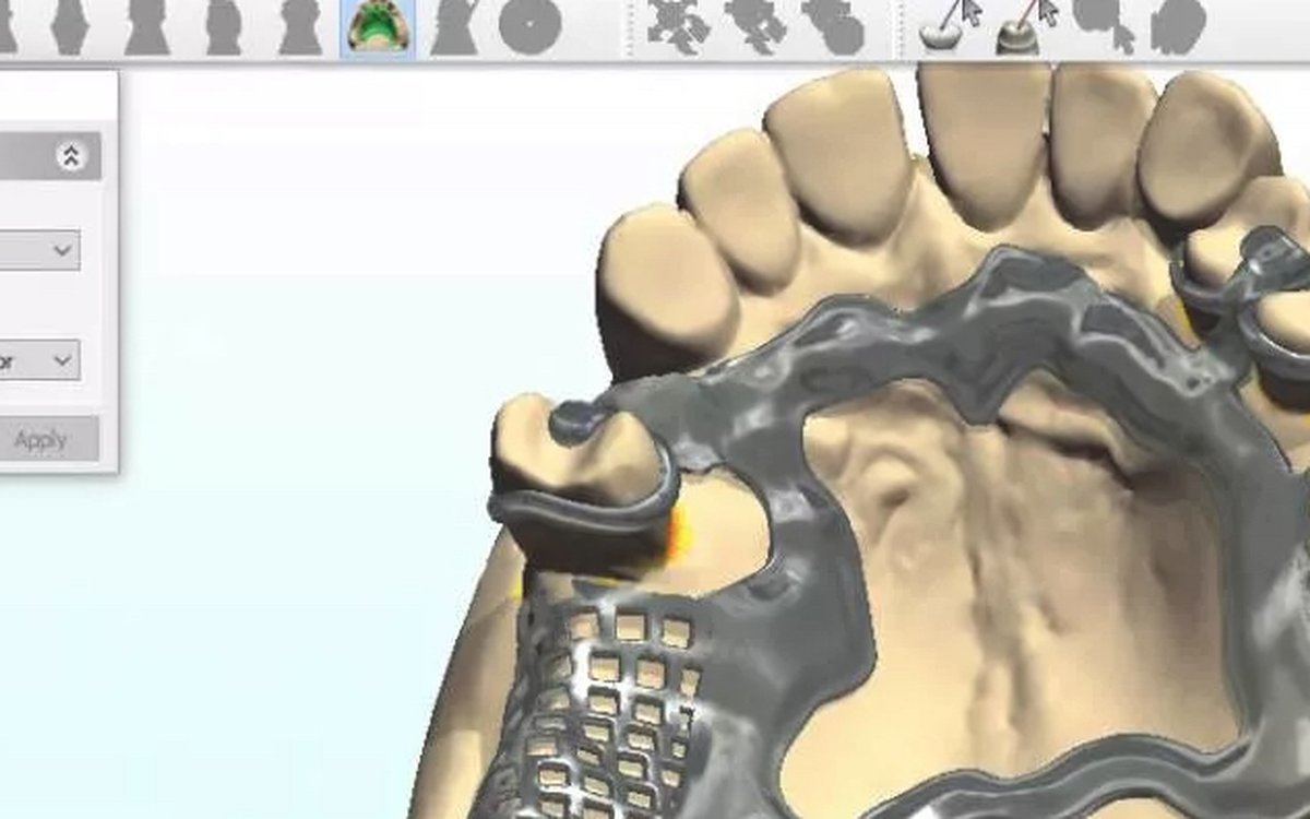 Installation of 3Shape Dental System — CAD/CAM Software