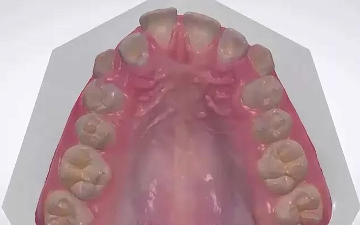 Installation of OrthoAnalyzer — Orthodontics