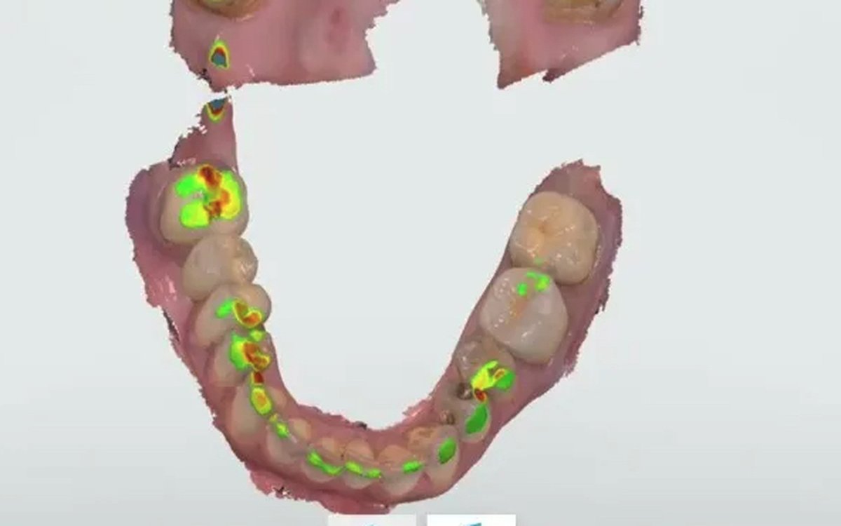 Installation of 3Shape TRIOS Software — CBCT & DICOM Viewers