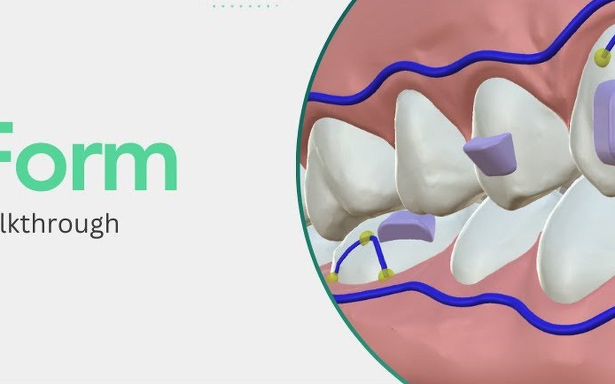 Installation of ArchForm — Orthodontics