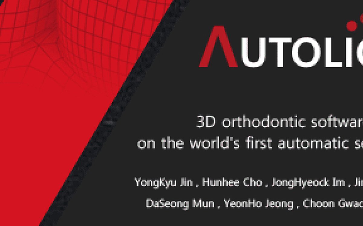 Installation of Autolign 3D — Orthodontics