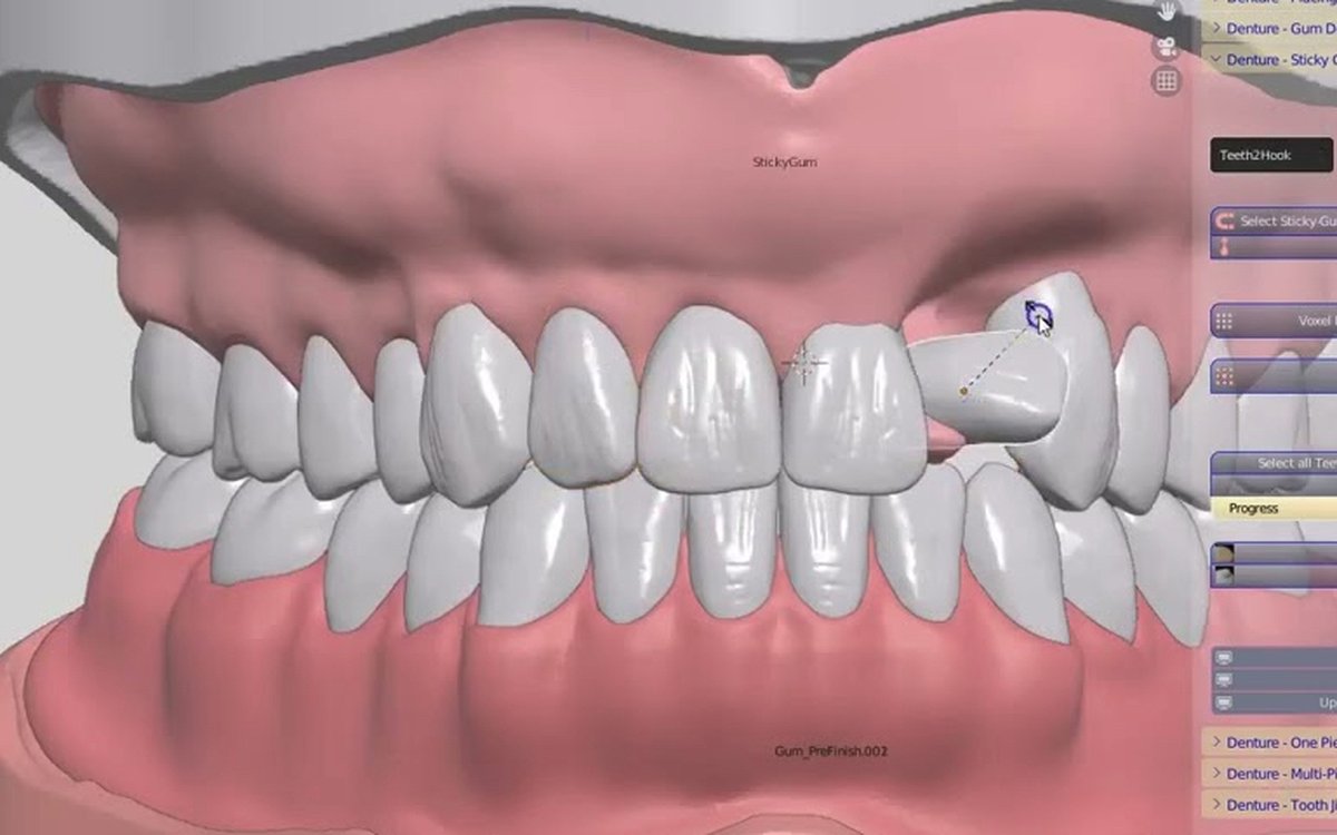 Installation of Blender4Dental — CAD/CAM Software