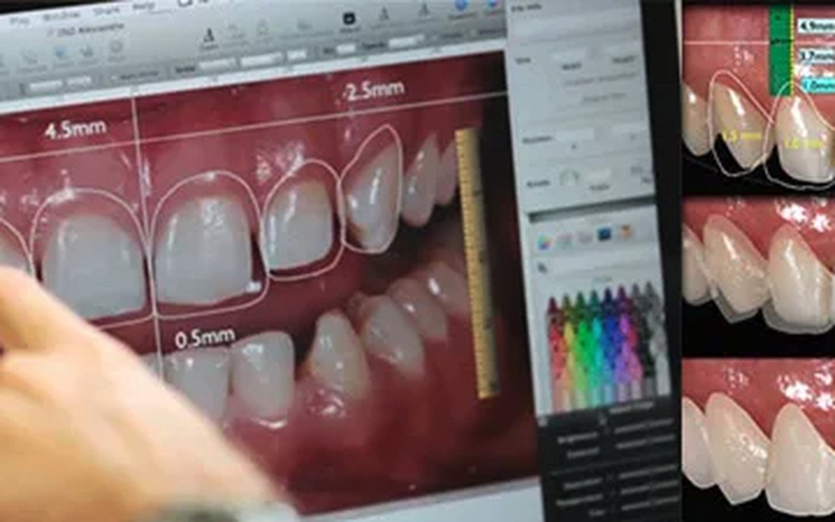 Installation of CEO New Design — CAD/CAM Software