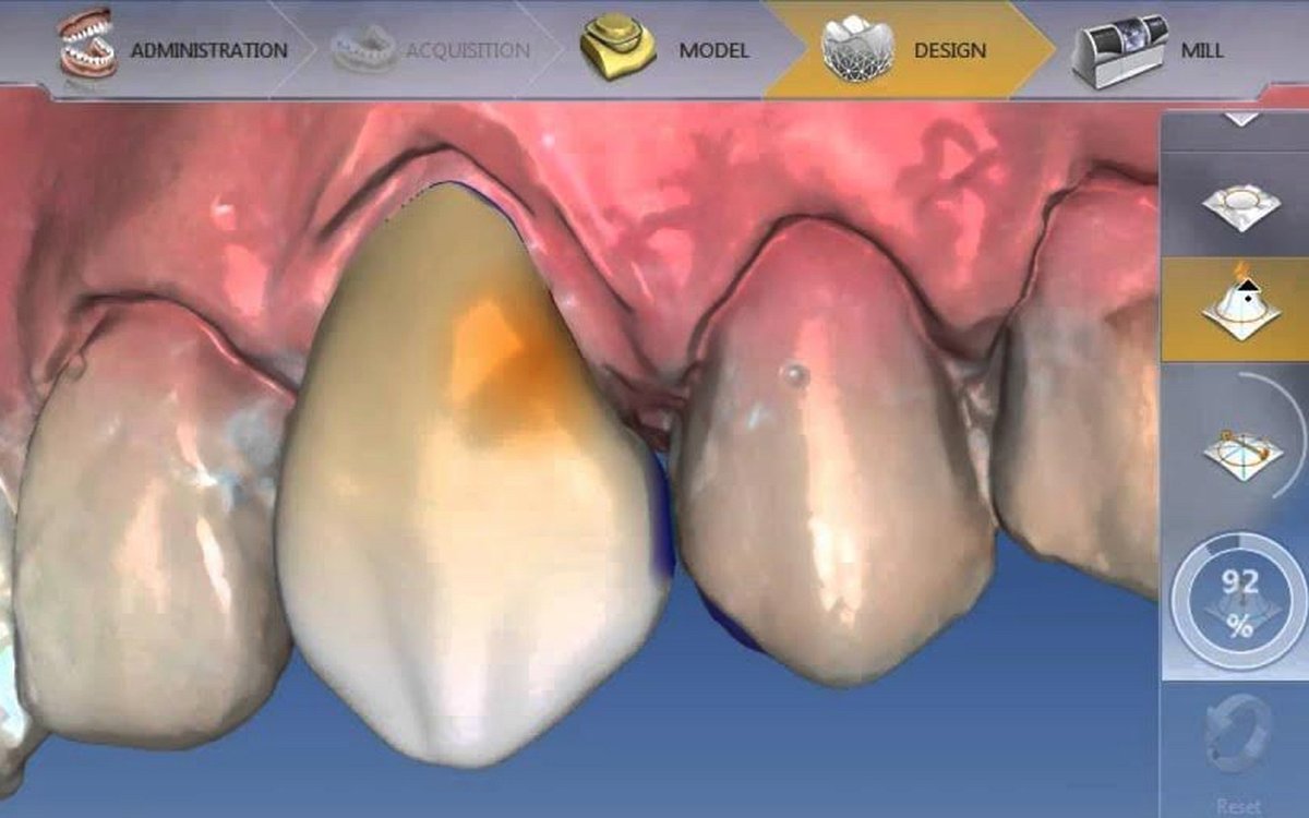 Installation of CEREC SW (Dentsply Sirona) — CAD/CAM Software