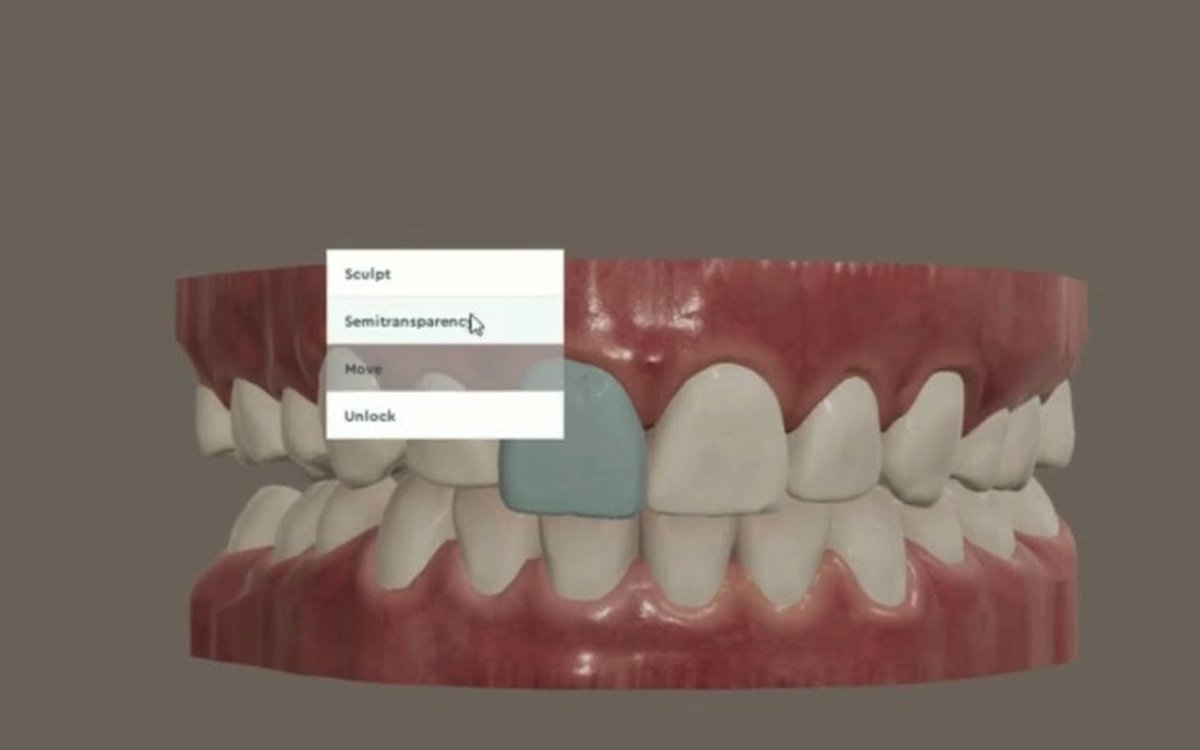 Installation of Dental 3DS — CAD/CAM Software
