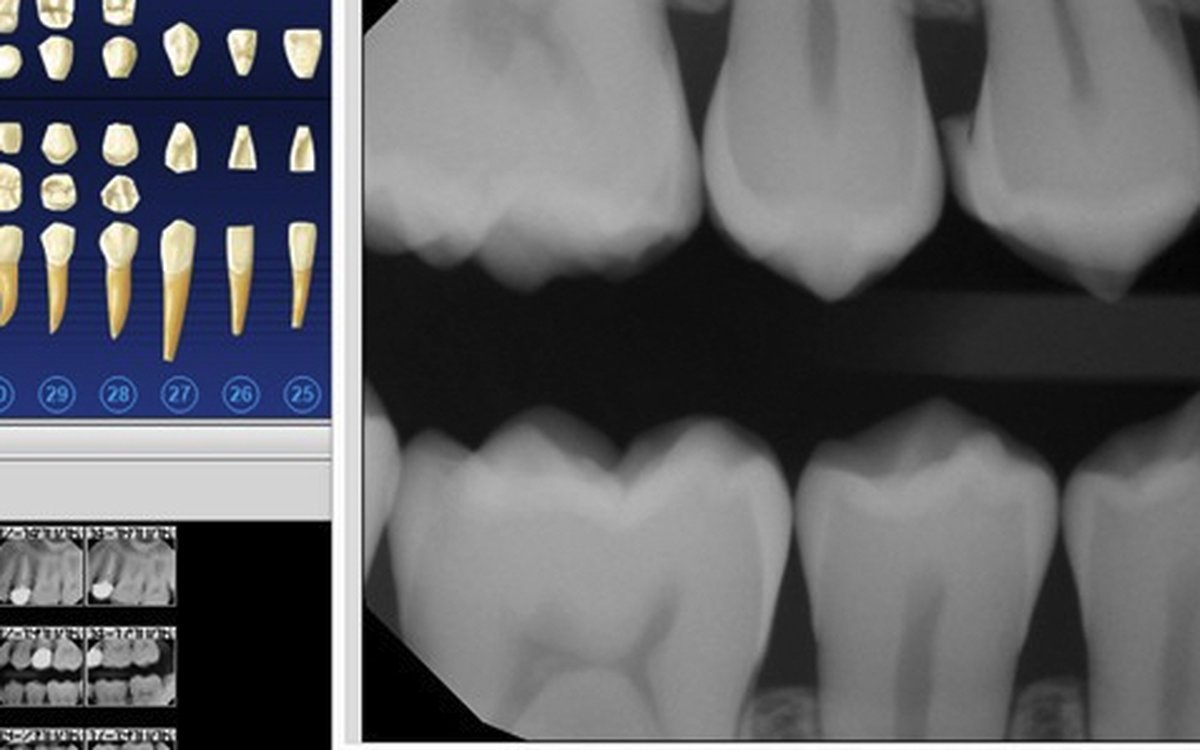 Установка Dentrix Imaging — КЛКТ и DICOM-просмотр