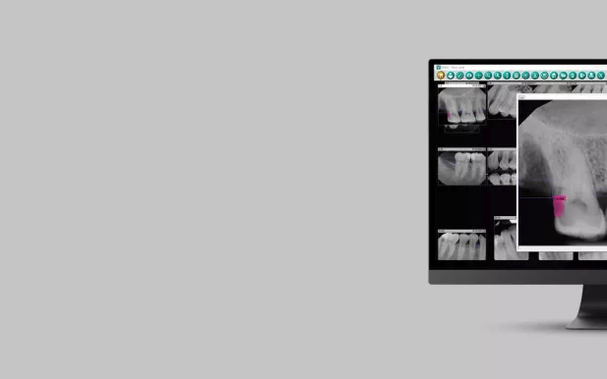 Установка DEXIS Dental Imaging — КЛКТ и DICOM-просмотр