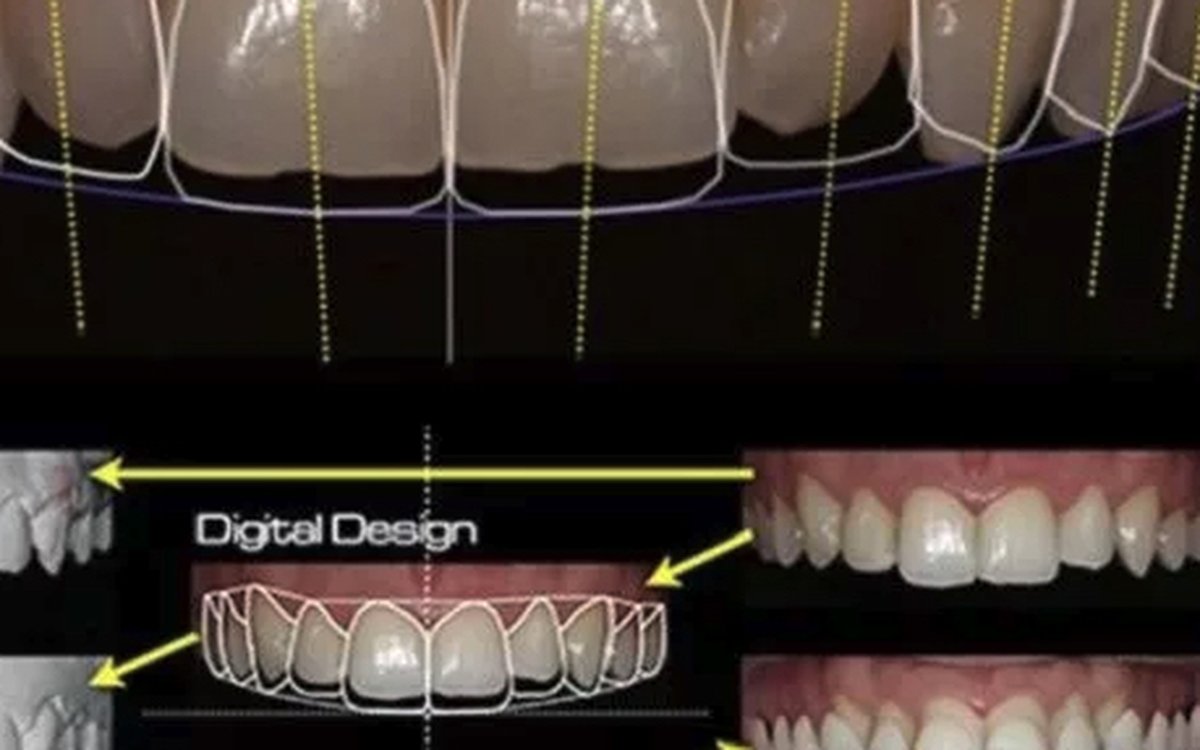 Installation of DSD — Digital Smile Design — CAD/CAM Software