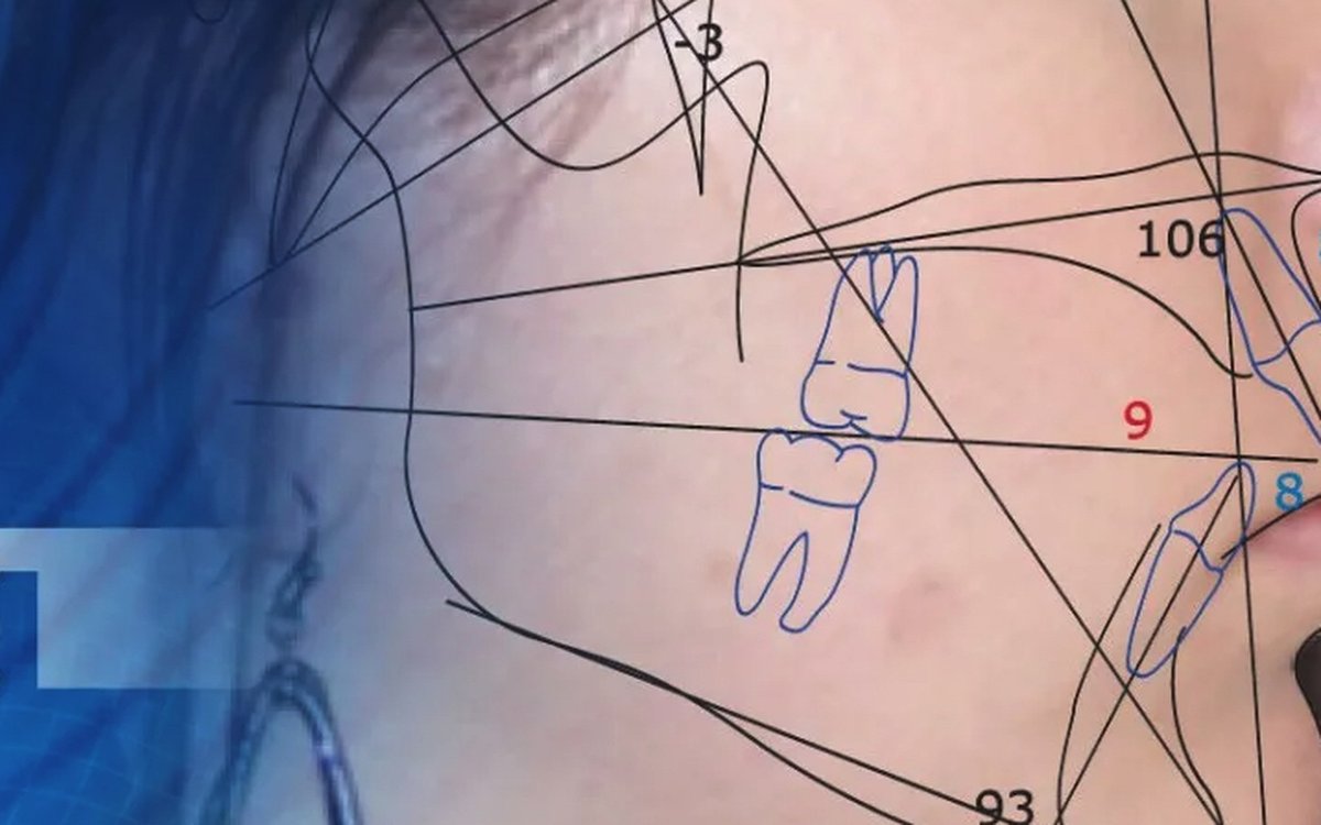 Installation of Dolphin Imaging — Orthodontics