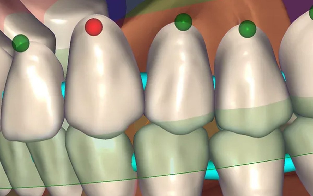 Installation of Exocad DentalCAD — CAD/CAM Software