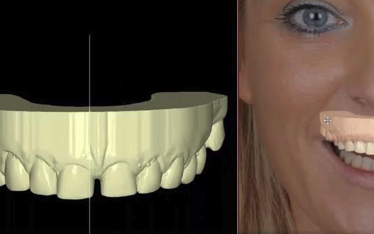 Installation of NemoStudio — Orthodontics