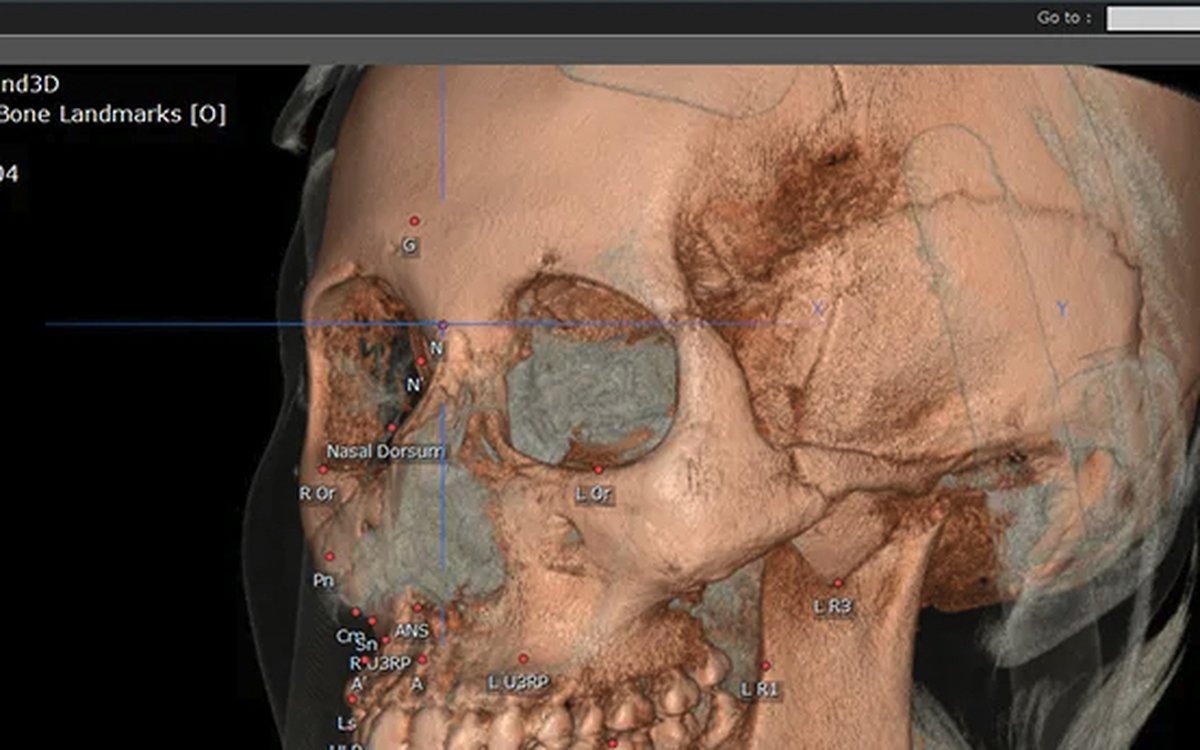 Установка OnDemand3D — КЛКТ и DICOM-просмотр