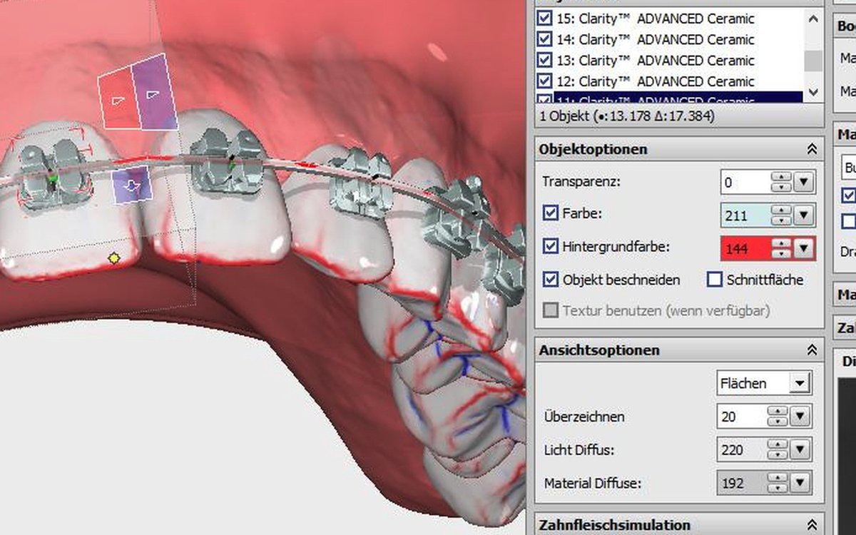 Installation of OnyxCeph³ — Orthodontics