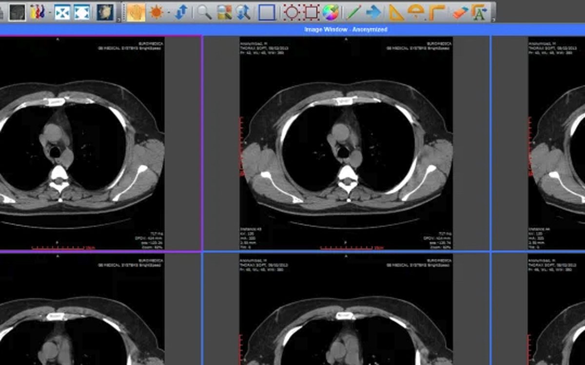 Установка Sante DICOM Editor — КЛКТ и DICOM-просмотр