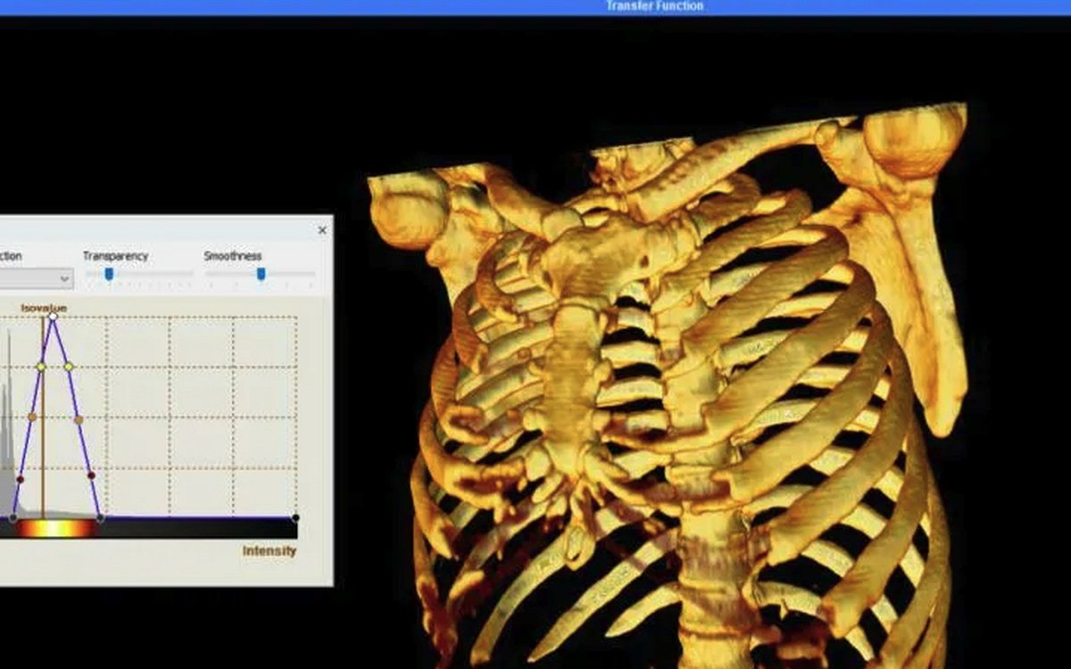 Установка Sante DICOM Viewer Pro — КЛКТ и DICOM-просмотр