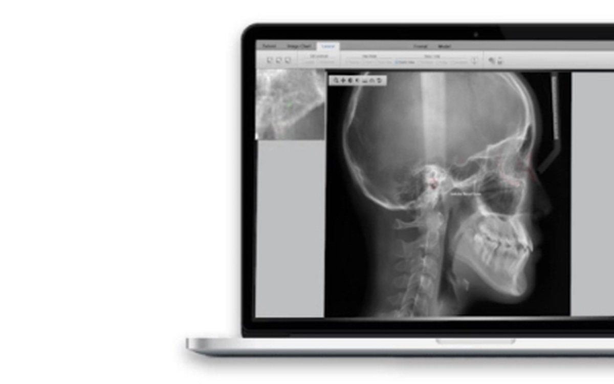 Installation of SmartCeph — Orthodontics