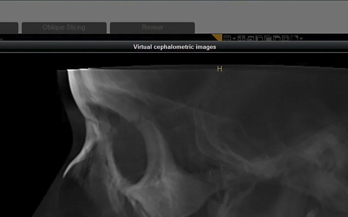 Установка Trophy3D CS 3D Imaging — КЛКТ и DICOM-просмотр