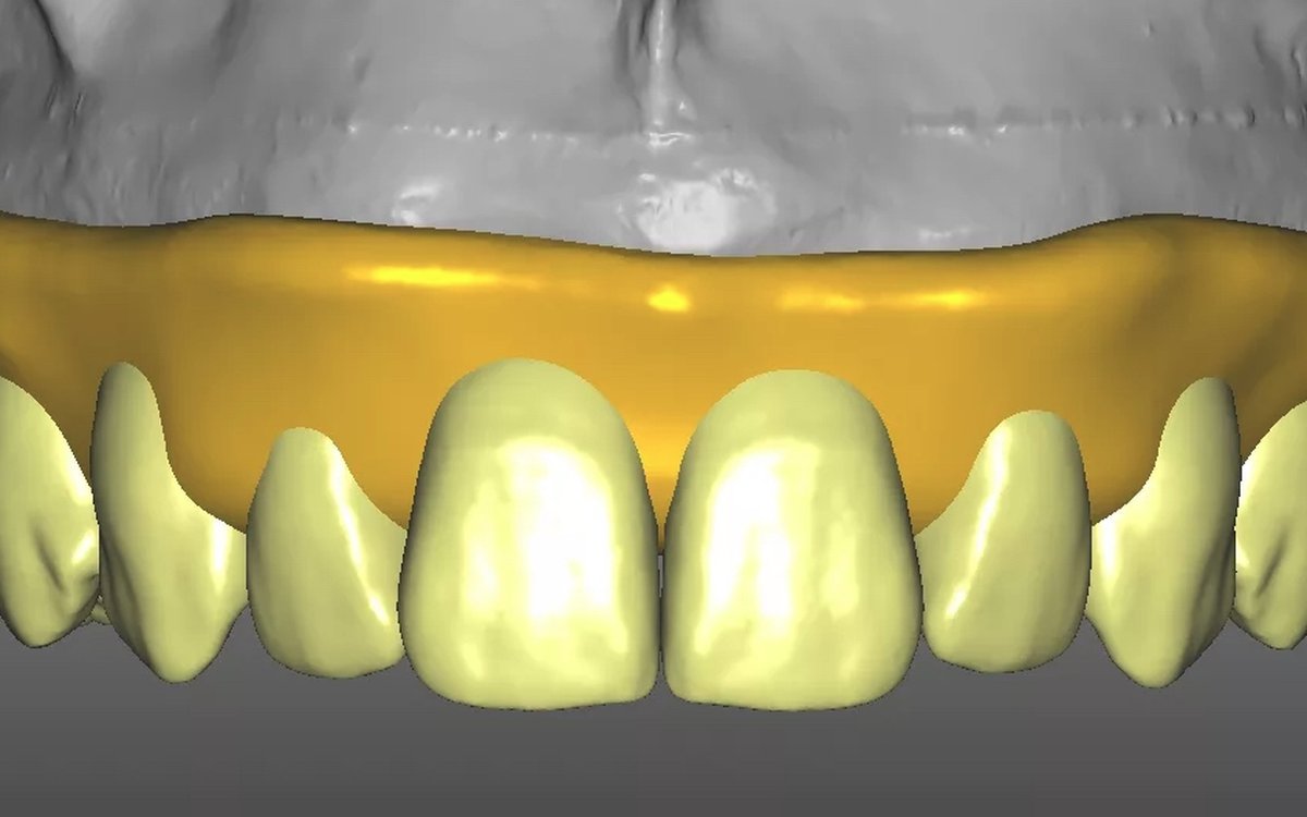 Installation of Zirkonzahn.Modellier — CAD/CAM Software